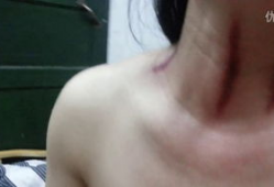 揪脖子痧视频,轻松缓解颈部酸痛的神奇疗法